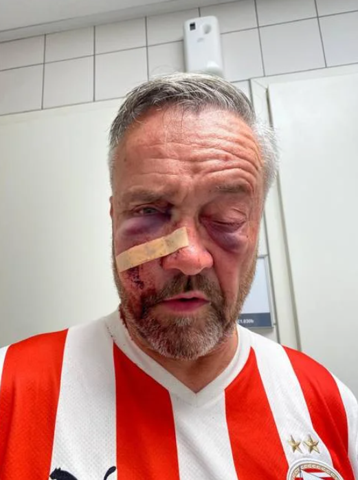 Man mishandeld